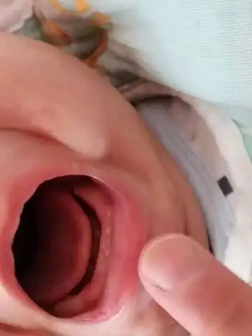 有没有影响!_育儿问答_宝宝树