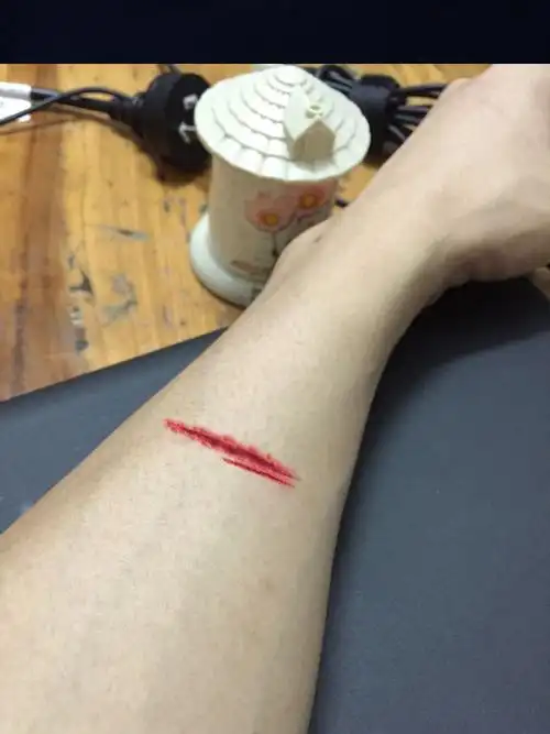 求ps大神帮忙p个小伤口在手上