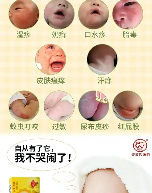 婴宝维肤膏抑菌消肿蚊虫叮咬湿痒疹宝宝皮肤瘙痒婴儿童止痒药膏