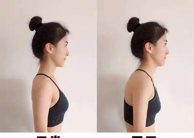 杨超越唯美直角肩,内扣圆肩如何升级直角肩?