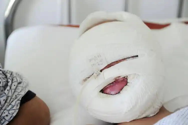 护士在小朋头顶的纱布上写着护理时间.