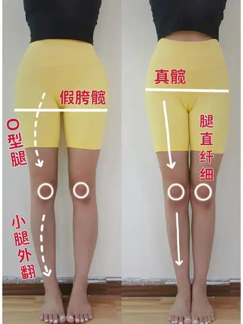 o 型腿矫正简单6个动作97让你的腿变得又长又直,夏天拥有明星腿.