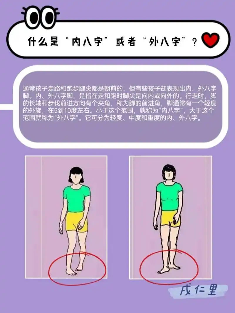 有没有出现内八或者外八这种状况0198 快来康康07 内外八字脚和