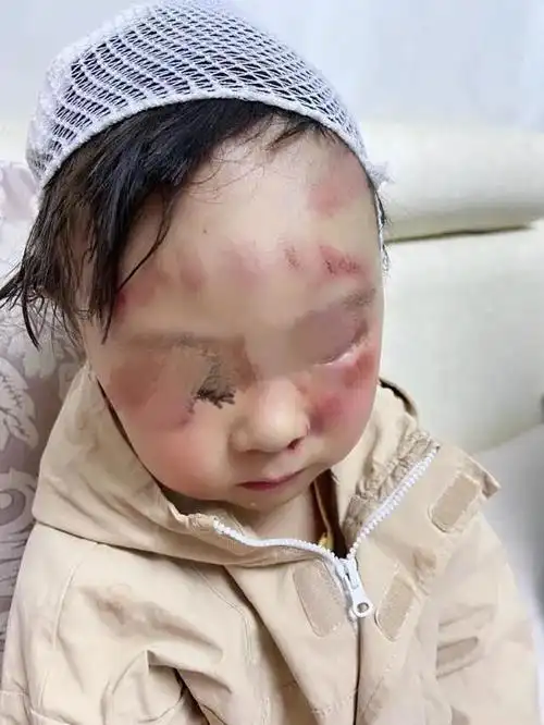 溧阳一儿童在汽车公园游玩中受伤,园区称索赔超3500可能涉及敲诈