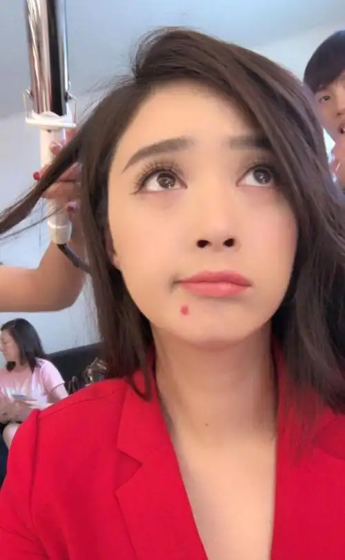 女明星也会长痘痘蒋欣的大红痘就超抢眼