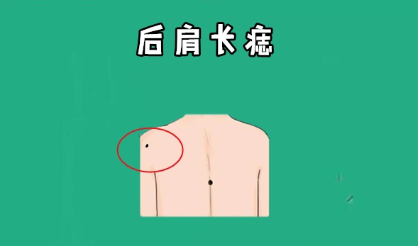 身体4颗"发财"吉痣,命中带金,有钱花不完,越老越有钱!