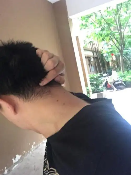 您好,请问大神,我这边后脑靠脖子手指这个地方好像有一颗淋巴结肿大一