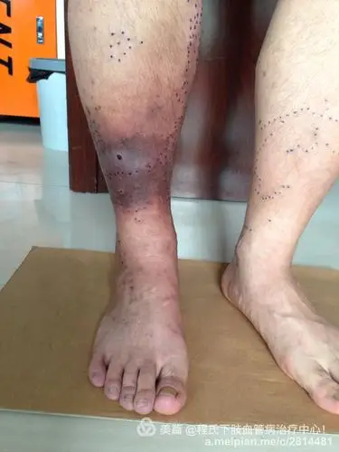 谢谢朋友的信任!