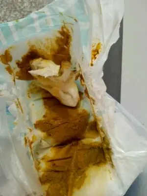 宝宝这几天大便颜色是土黄色的,差不多一天一次,粘稠伴有几小块陀状的