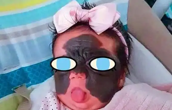 蝙蝠侠宝宝火了因脸上黑色胎记遭网暴这种怪物就该杀掉