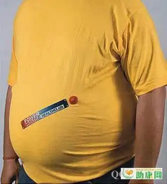 p>啤酒肚,又叫"罗汉肚".