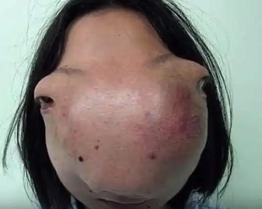 史上的那些怪异的畸形人