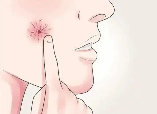 39岁男子,确诊肝癌,喝酒者,出现5种异常,去查查肝脏_腾讯新闻