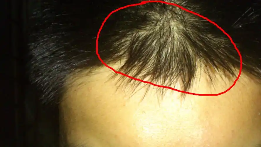 头顶最前面中间那里骨头特别凸出,摸起来像是个椭圆形的骨头