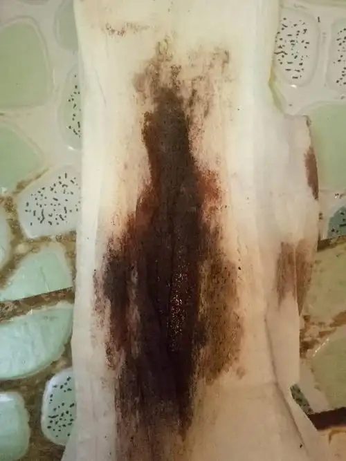 我的月经干净第四天又来了,而且来的还是黑的,请问一下专家是怎么回