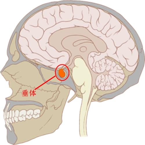 你的"男"言之隐可能与脑袋有关!_垂体瘤 - 好大夫在线