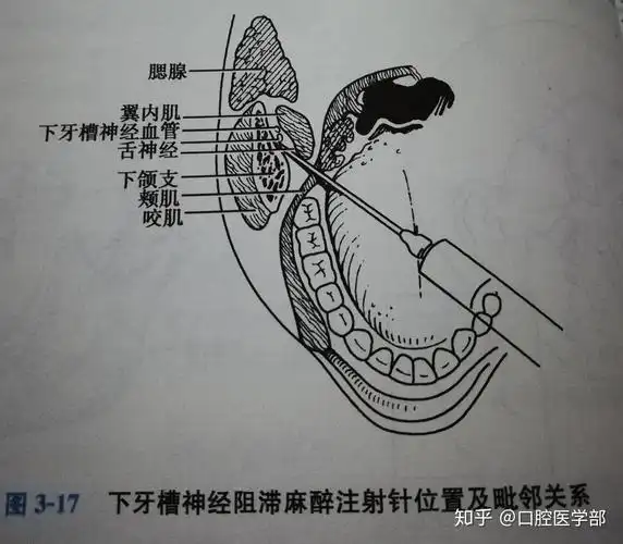 口腔颌面部阻滞麻醉图解