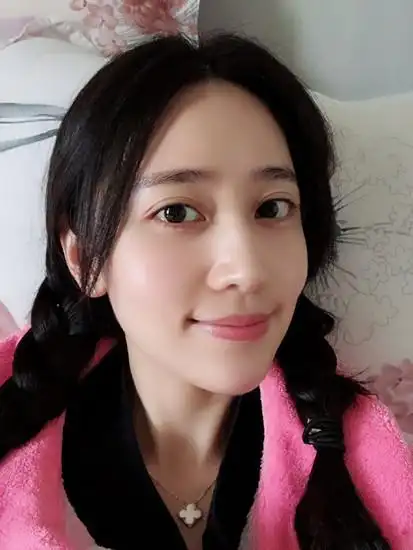 如今的张玮玮一直美,怎麼看都像整容了,变化有点大.