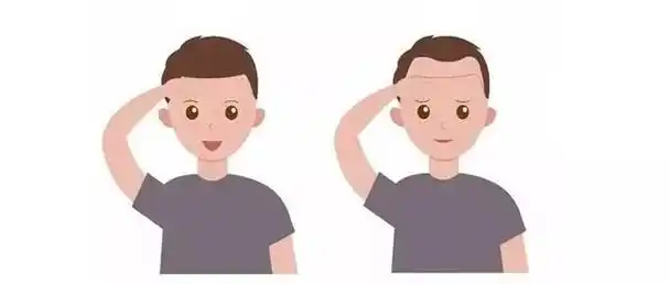 发际线怎么算正常,眉上4指才是正常发际线-相术-荣耀易学