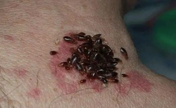 家里臭虫多,有什么办法能彻底消灭?