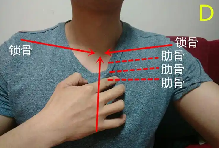 健康贴士女性副乳如何改善