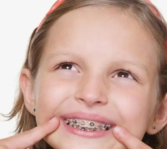 原创熊黛林双胞胎女儿越长越不像一个甜美可人一个有点龅牙