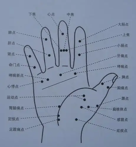 手掌大小鱼际位置图 (第1页)