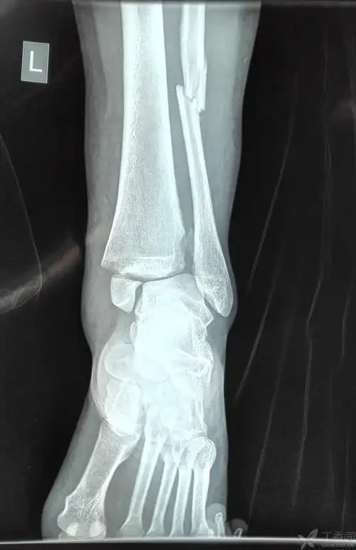 下一步该咋办? [精华] [病例帖]