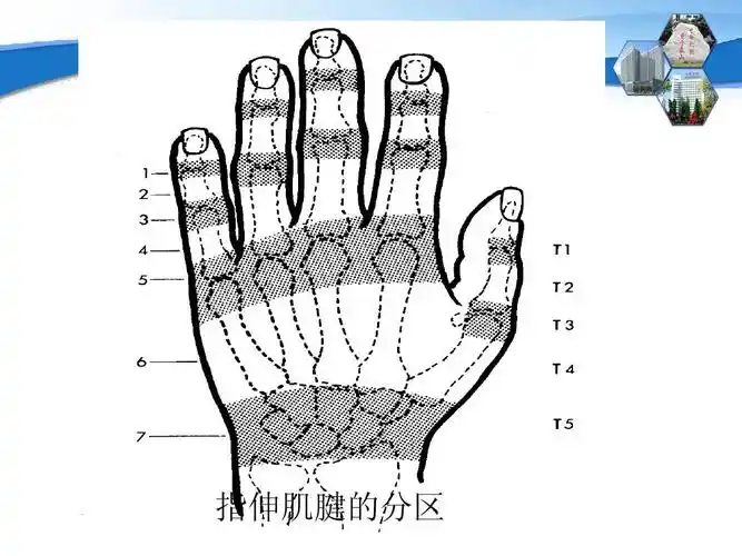 指伸肌腱的分区