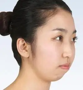 面相: 短下巴的人命运到底怎么样