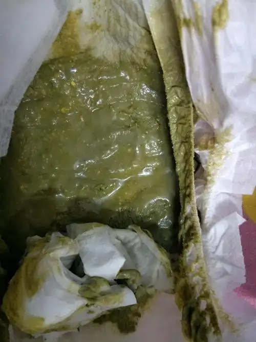 各位宝妈们看看我闺女拉的屎怎么回事啊?