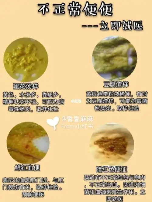 (4)细菌感染病毒或细菌感染引起的腹泻.