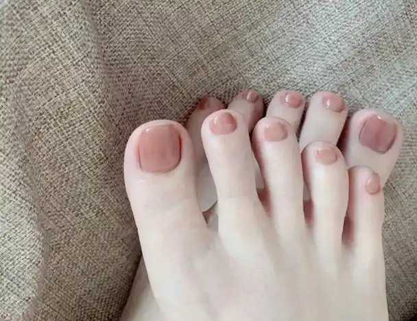 小脚趾甲长成"两瓣"的人,究竟是什么来头?瓣状甲是否有危害?