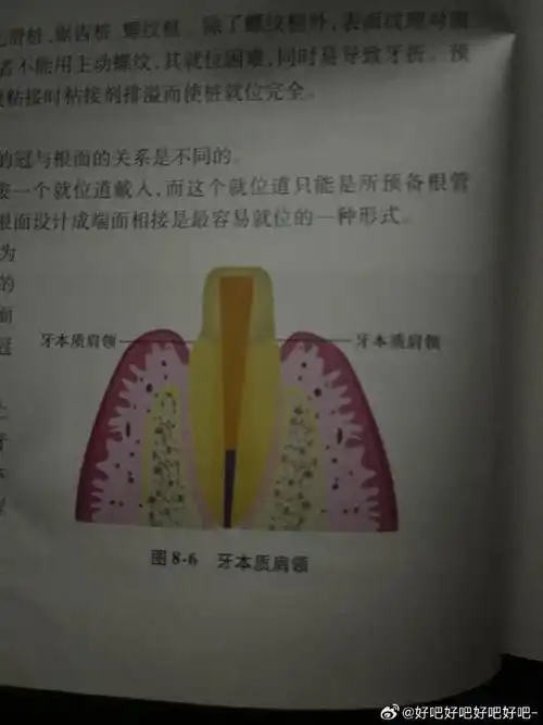 整牙##根管治疗##缺牙