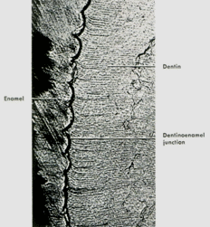 2018口腔组织病理学考点牙釉质的组织学结构