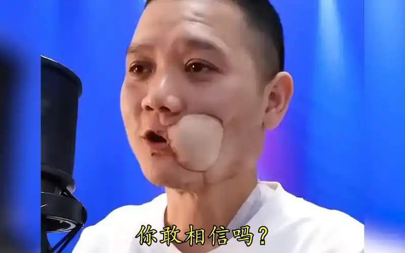 年薪百万的男歌手嚼槟榔6年患癌去世,脸部溃烂流脓,太可怕了!