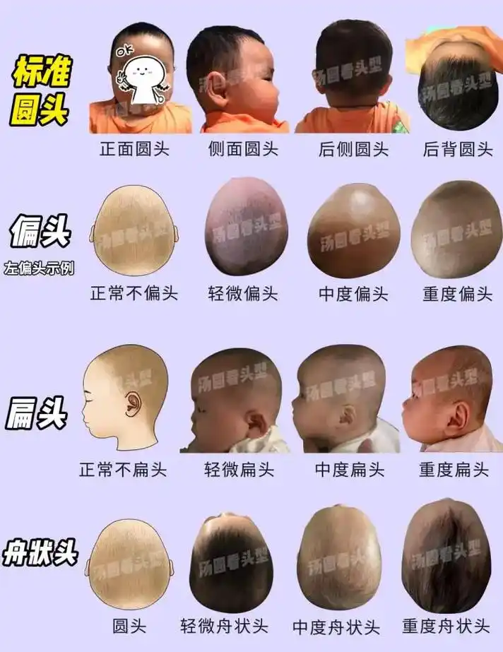 睡圆头实操|完美头型直接睡出来.