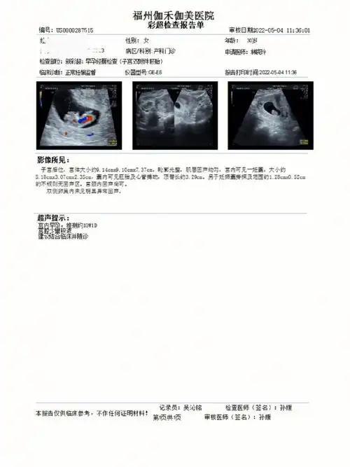 孕九周孕十周b超单血值报告