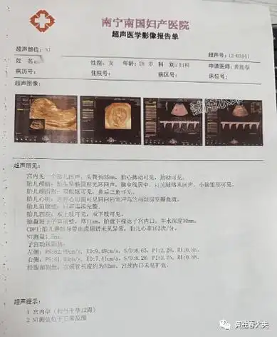 孕早期超声:我们先看看早孕期的孕三项:本次孕期血值监测:她,弓形子宫
