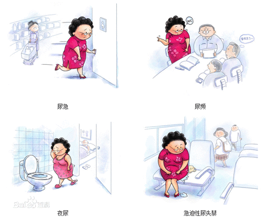 症状为特征的综合征,常伴有尿频和夜尿症状,可伴或不伴有急迫性尿失禁