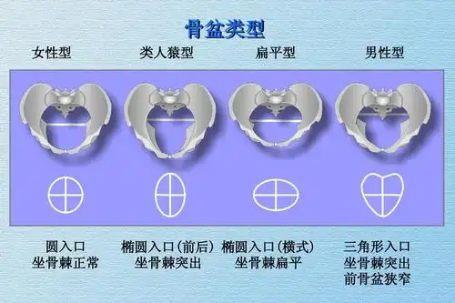 胎位异常的处理 骨盆类型 女性型 类人猿型 扁平型 男性型 圆入口
