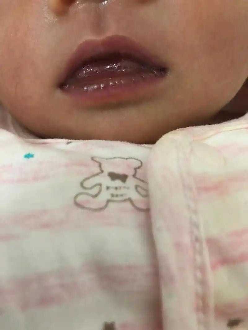 为什么嘴发紫(嘴发紫什么情况)