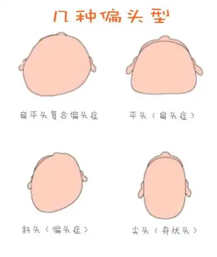 如何避免方颅,教你给宝宝睡个滚滚头