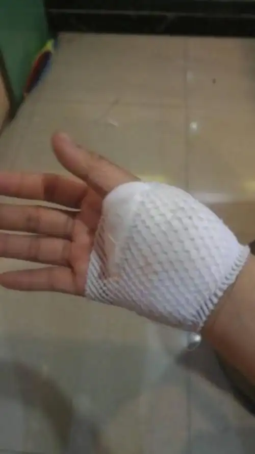 手这样包扎通常是怎么了