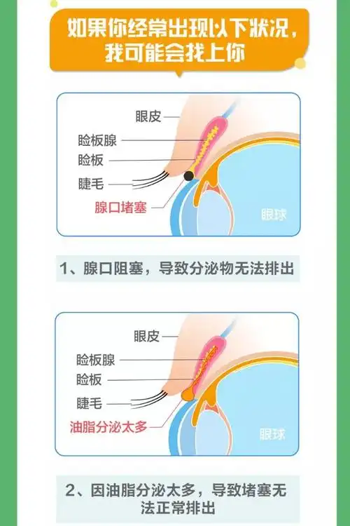 通常睑板腺会分泌油脂类物质,有助于保持眼睛湿润.