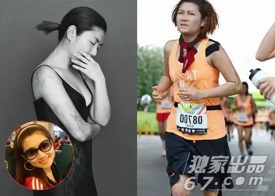 selina大方展露烧伤疤 网友动容