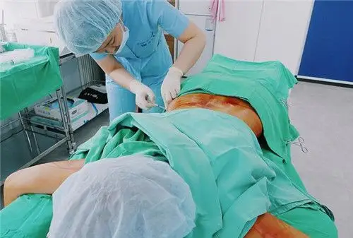 韩国丽优美腹部迷你吸脂手术恢复快吗?