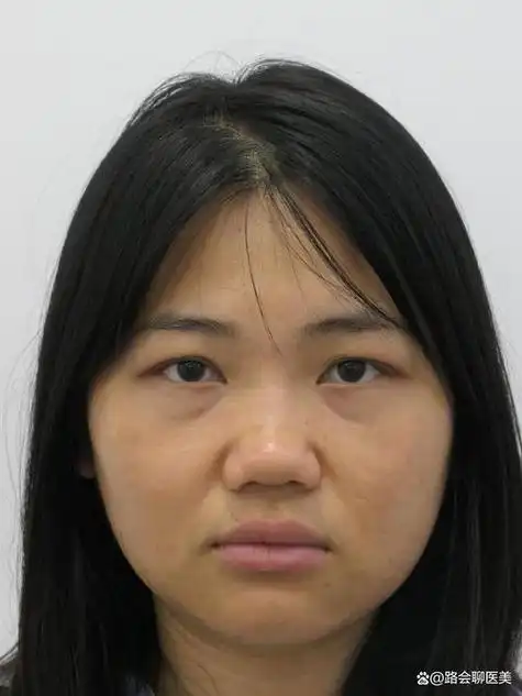 蒜头鼻面相好不好