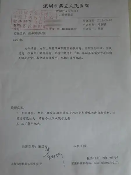 鼻窦骨折ct报告