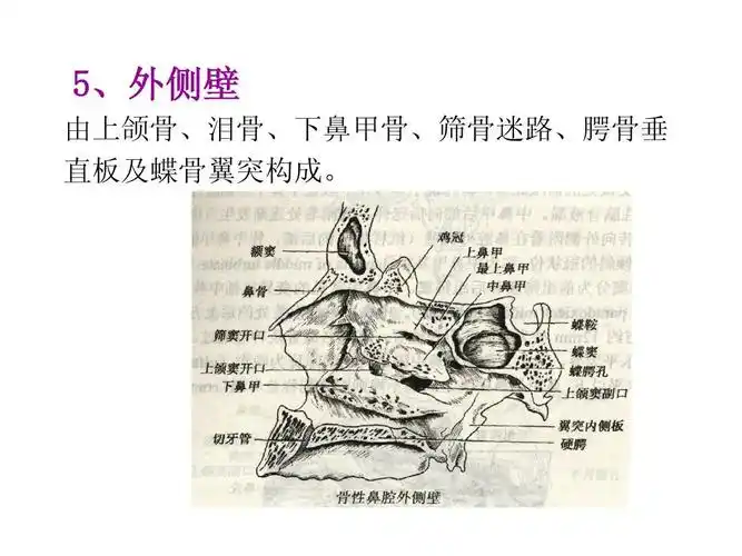 外侧壁 由上颌骨,泪骨,下鼻甲骨,筛骨迷路,腭骨垂 直板及蝶骨翼突构成